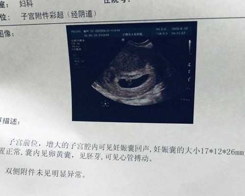 为什么分手后女孩判若两人?是爱让她们像孩子一样