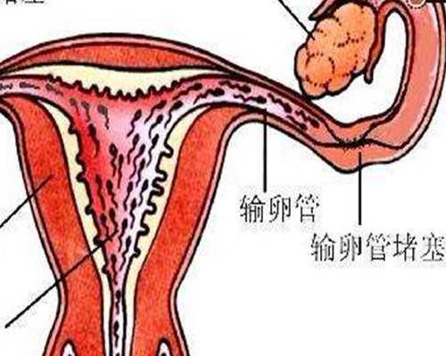 广州与沧州：一方患艾滋病，医院精子辅助生殖技术可助孕
