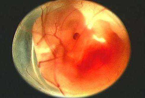 怀孕两个月突然出血，医生称胎停育，胚胎停止
