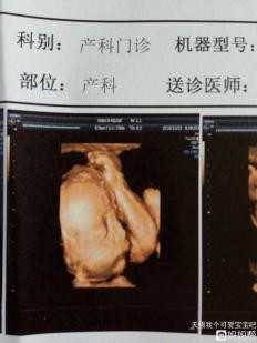 广州代生双胞胎地址_广州代生男孩中心_广州代孕包儿子