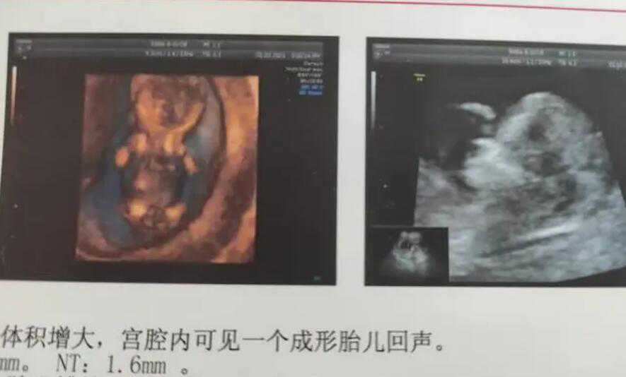 广州医科大学附属第六医院位于哪里 广州试管婴儿包生男孩想想就知道不可能