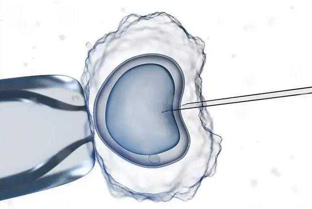 广州供卵试管婴儿选性别 2022年广州包男孩的试管医院有哪些 ‘b超四个月看男
