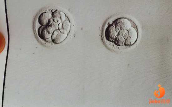 广州找供卵女|【广州地下供卵试管哪里有】顺利诞下小棉袄，讲讲我的顺产经